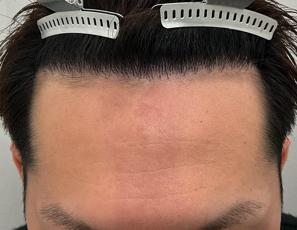 After