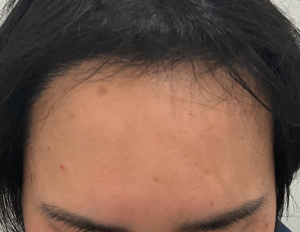 After