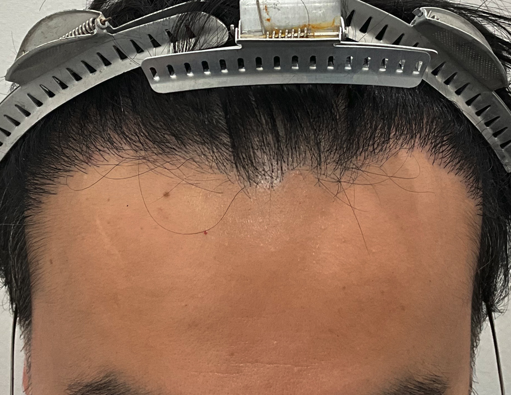 After