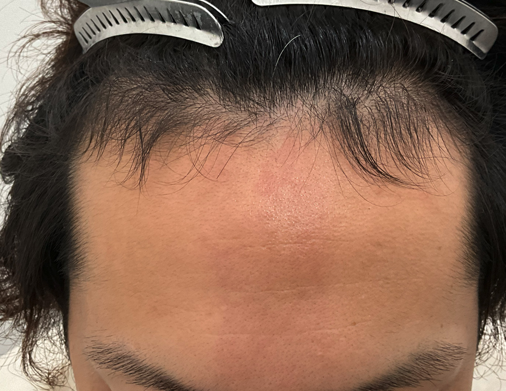 Before