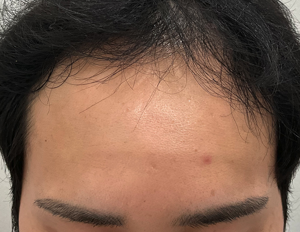 Before