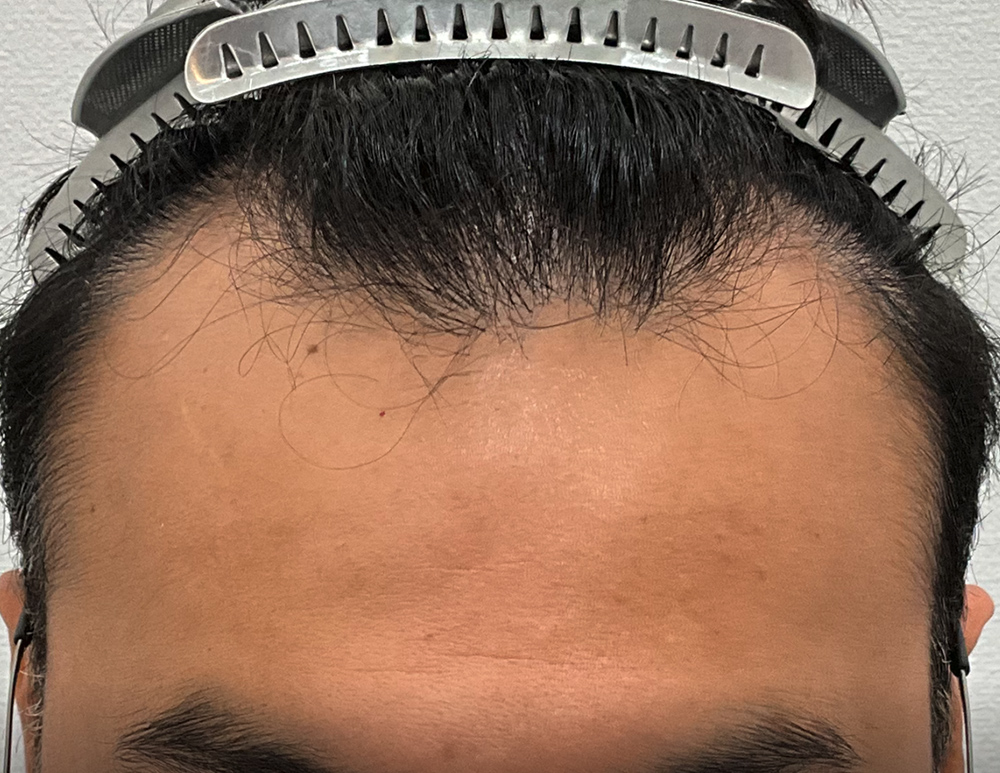 Before